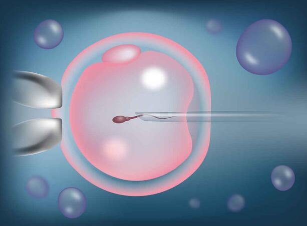 試管嬰兒移植后幾天著床