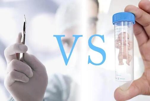 人工授精和試管嬰兒的區別