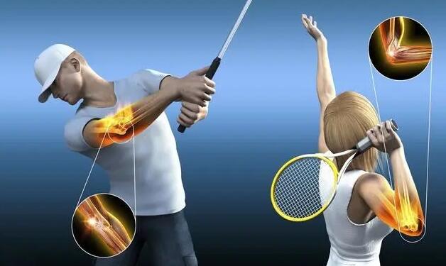 網球肘治療方法有哪些 網球肘治療方法有哪些