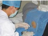 結(jié)核性脊髓炎