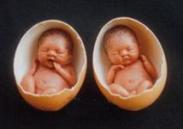 胎兒宮內發育遲緩